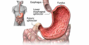 Lower esophageal sphincter 300x152 - Heartburn. Could It Really Be Due To LOW Stomach Acid?